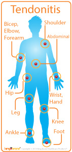 Areas of Tendonitis